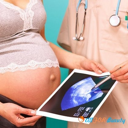 Три распространенных мифа, связанных с беременностью и родами
